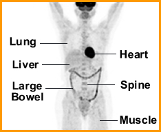 Discuss the nomral areas of FDG uptake