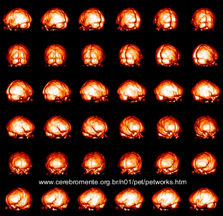 3-D Brain