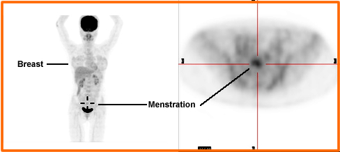 Identify normal/abnormal FDG uptake