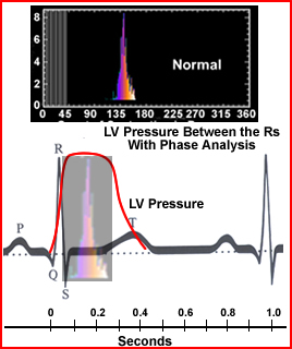 Comparing R to R / Phase Analysis / LV Pressure