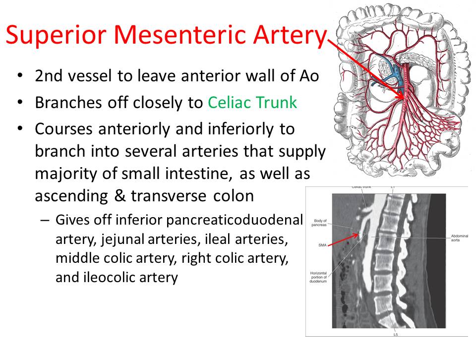 Slide11.JPG