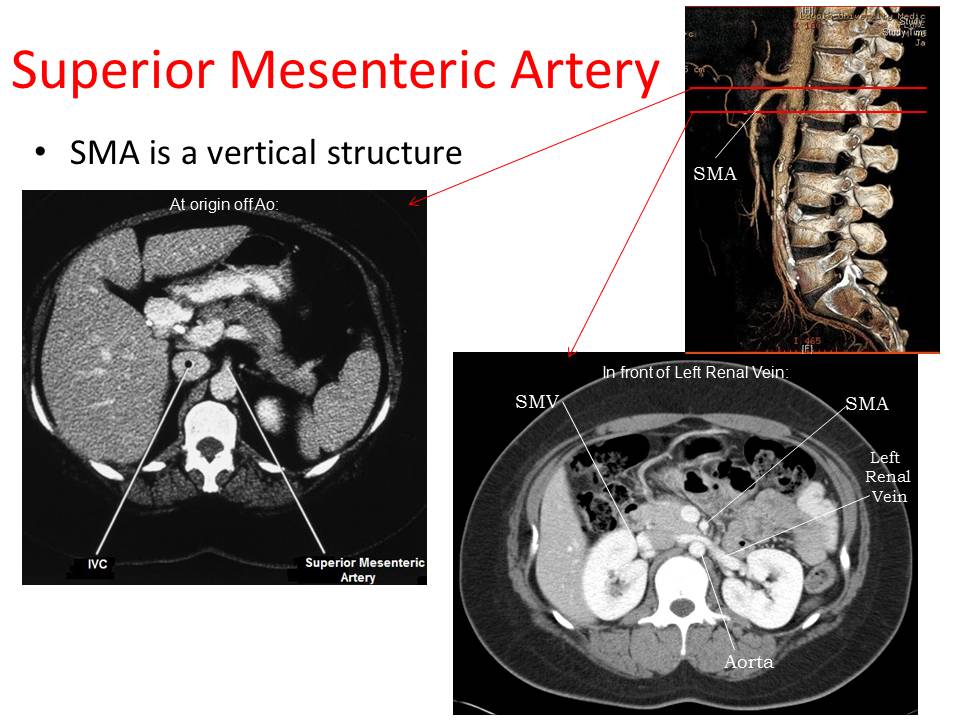 Slide12.JPG