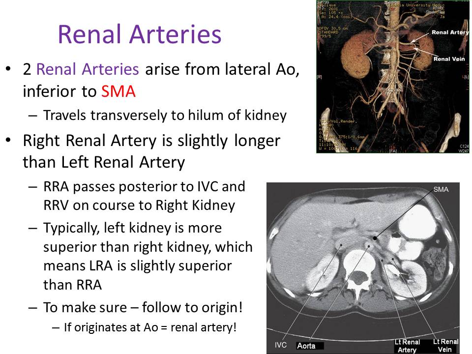 Slide13.JPG