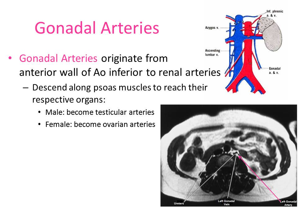 Slide15.JPG