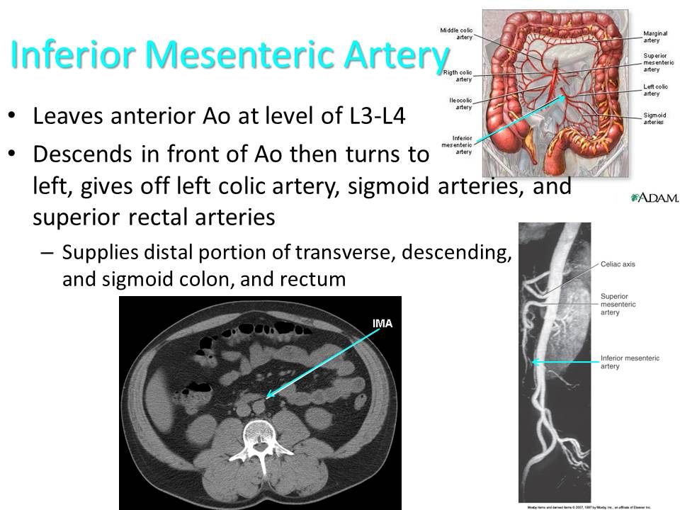 Slide17.JPG