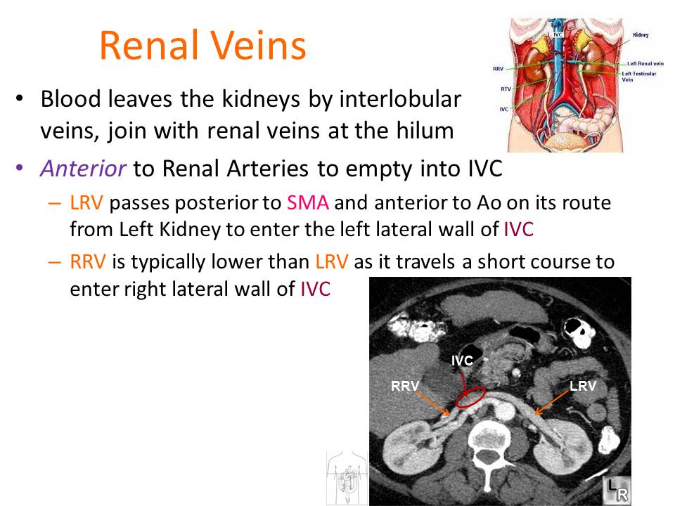 Slide26.JPG