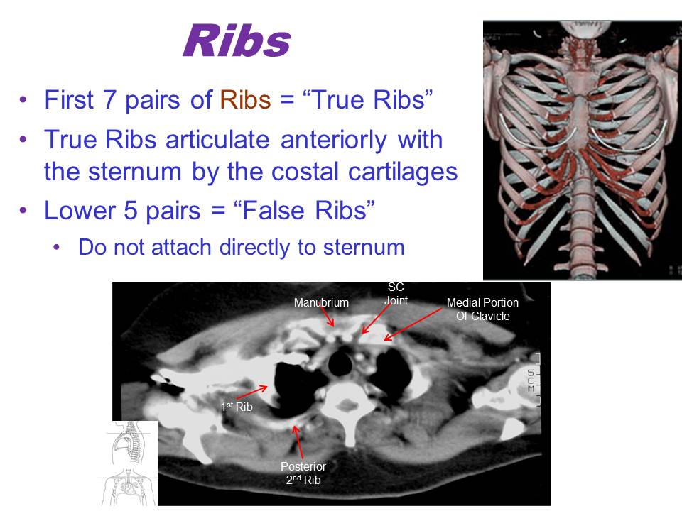 Slide11.JPG