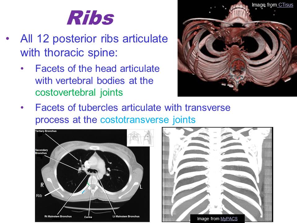 Slide12.JPG