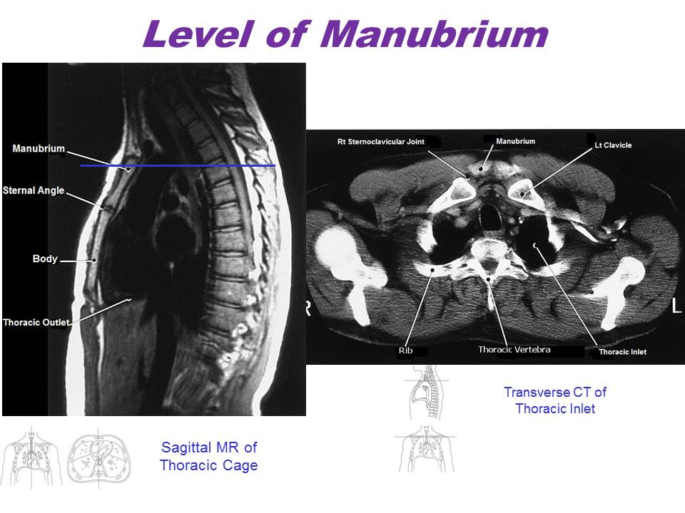 Slide6.JPG