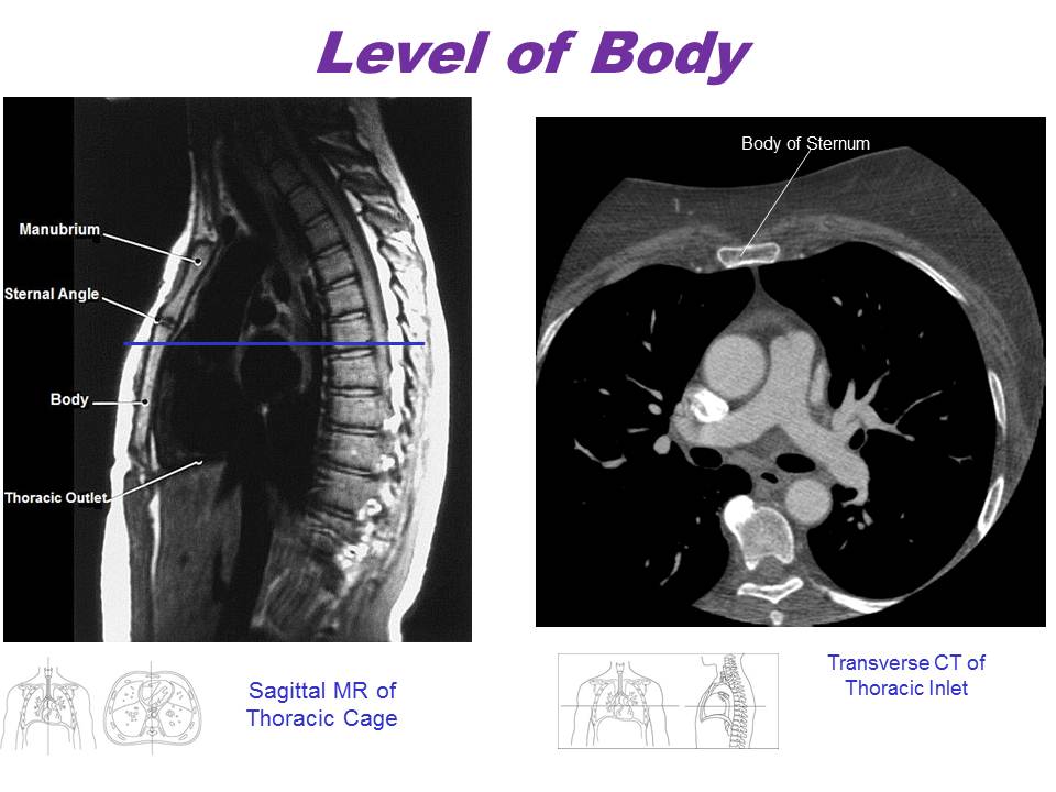 Slide8.JPG