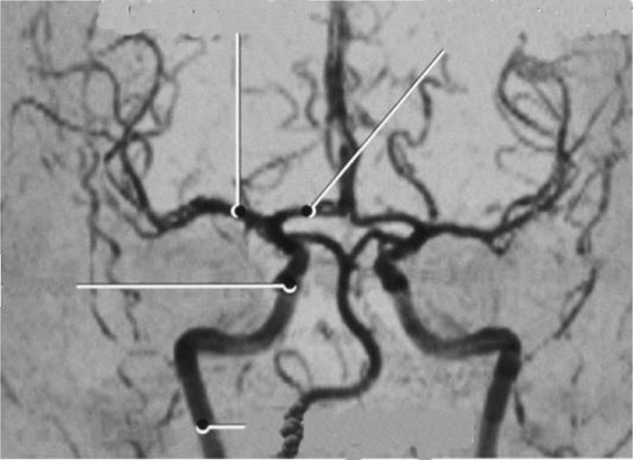 circleofwillis.jpg