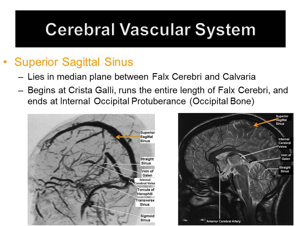 Slide15.JPG