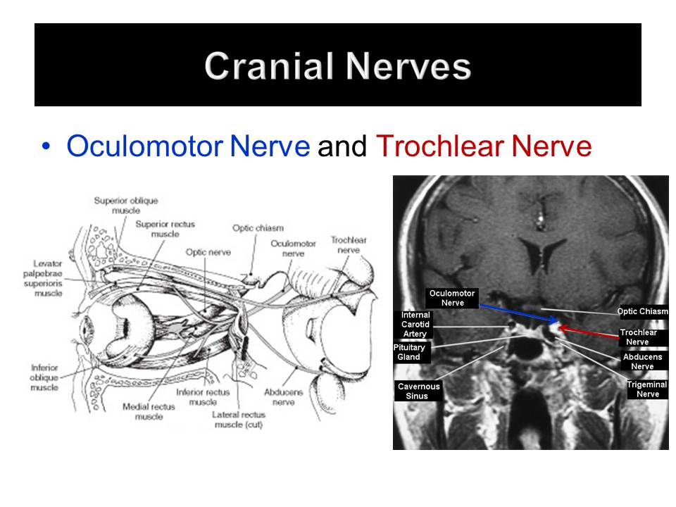 Slide26.JPG