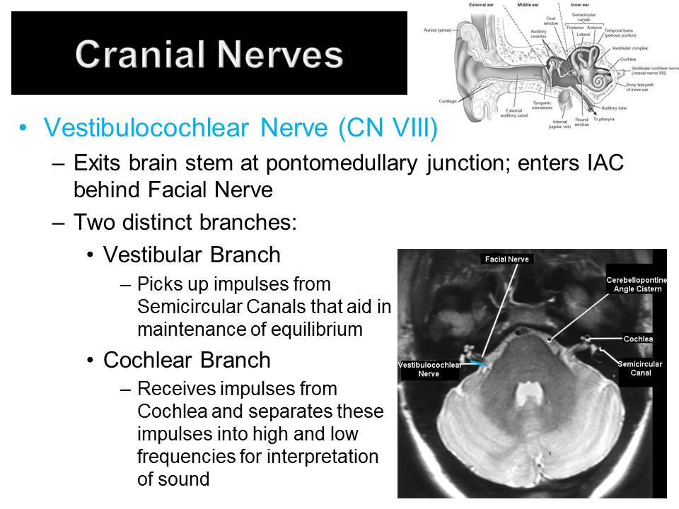 Slide31.JPG