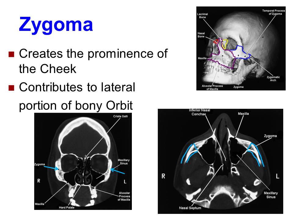 Slide10.JPG