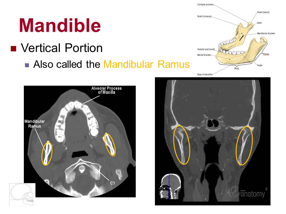 Slide16.JPG