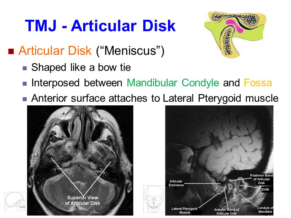 Slide20.JPG