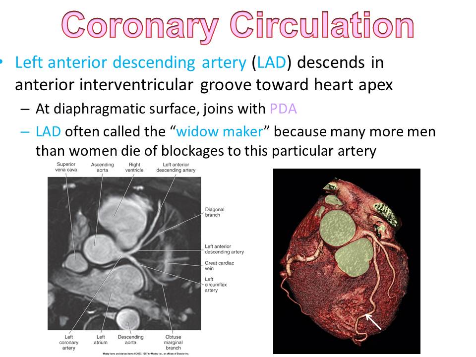 Slide28.JPG