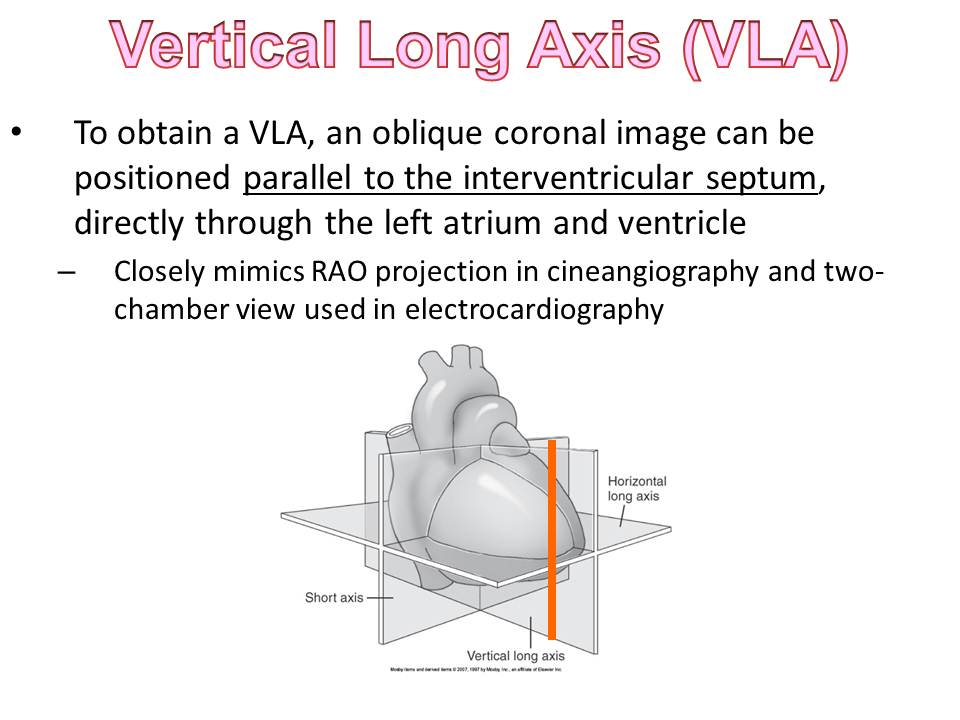 Slide33.JPG