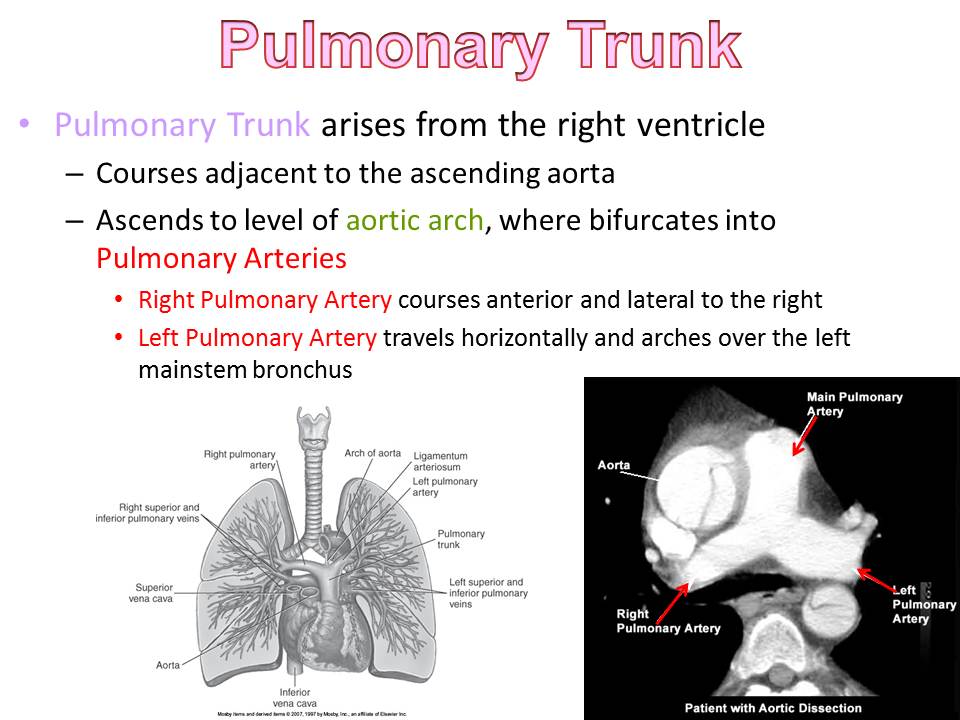 Slide51.JPG