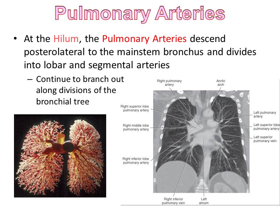 Slide52.JPG