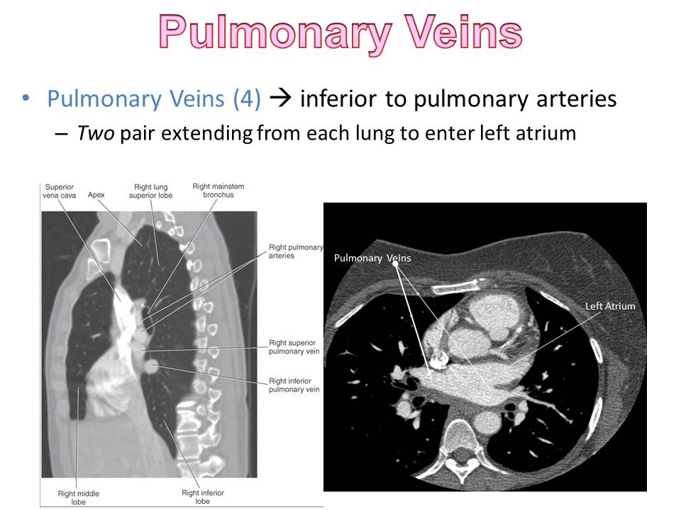 Slide53.JPG