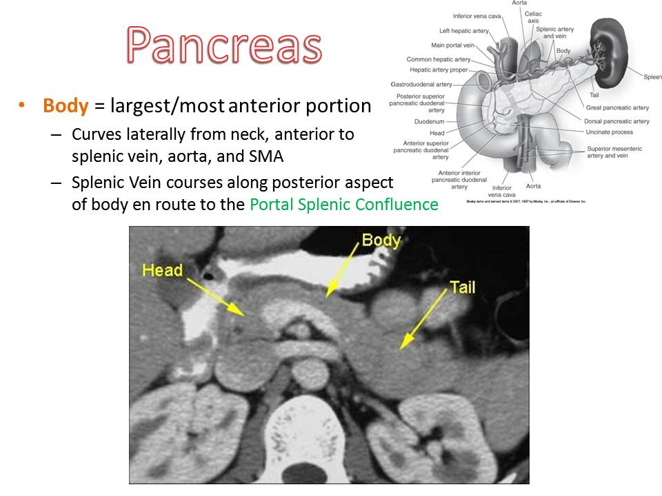 Slide6.JPG