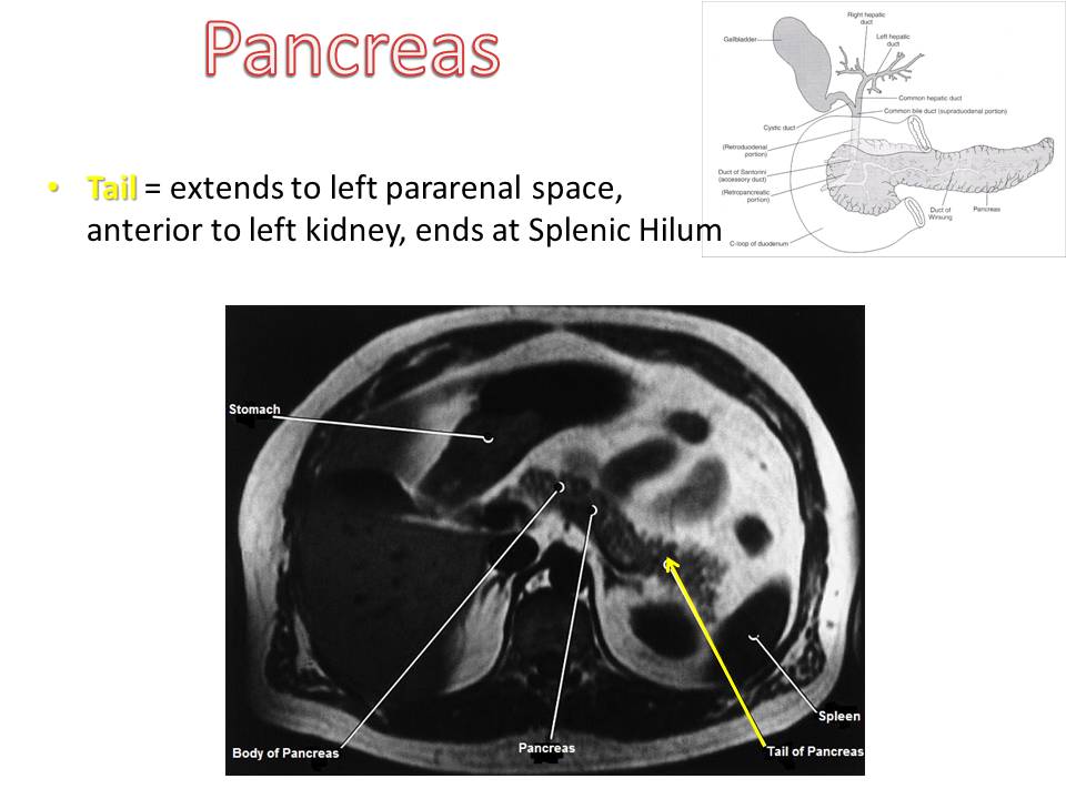 Slide7.JPG