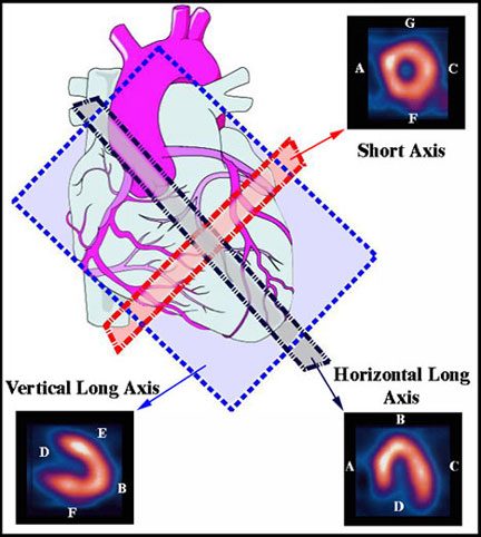 cardiacspectslicelabel.jpg - 53685 Bytes