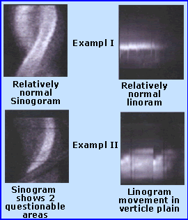 sinograms and linograms
