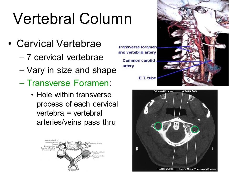 Slide14.JPG