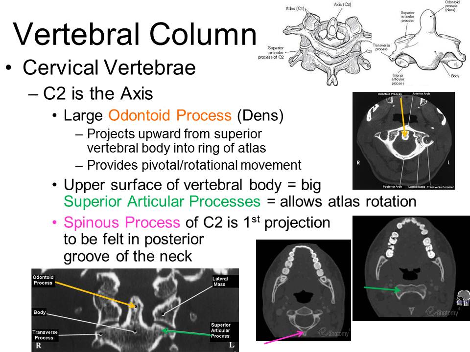 Slide17.JPG