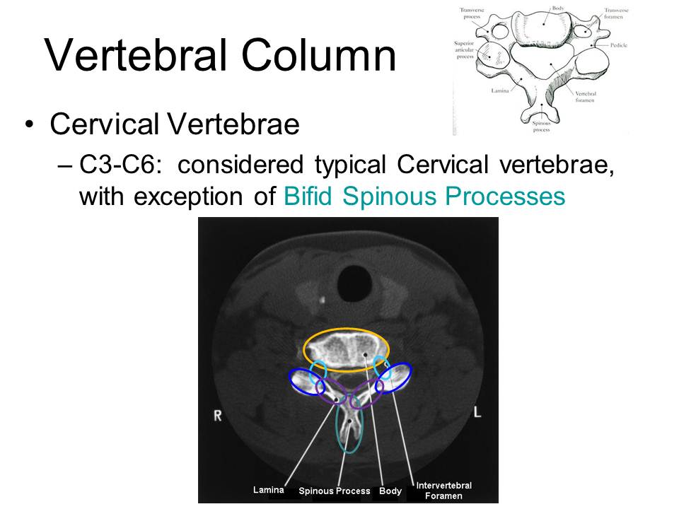 Slide18.JPG