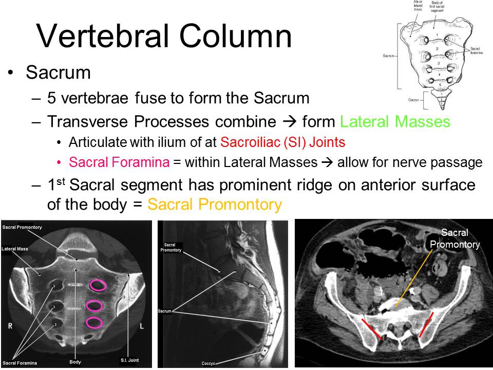 Slide23.JPG