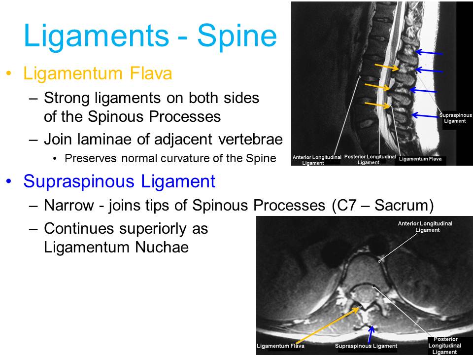 Slide28.JPG