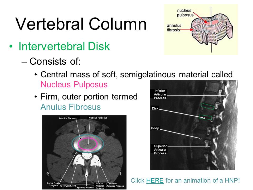 Slide8.JPG